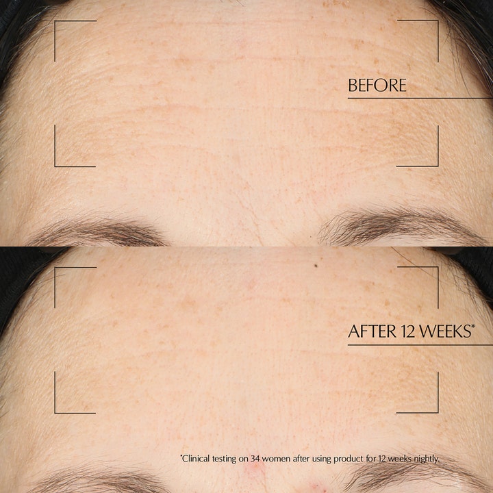 Estée Lauder Advanced Night Repair 65 ml nattmaske gir glattere hud og færre rynker vist i før og etter bilde.