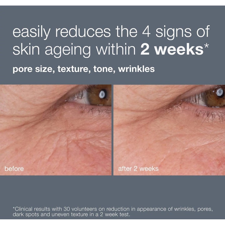 Dermalogica Dynamic Skin Retinol Serum 30 ml mot rynker viser før og etter resultat på hudtone og tekstur