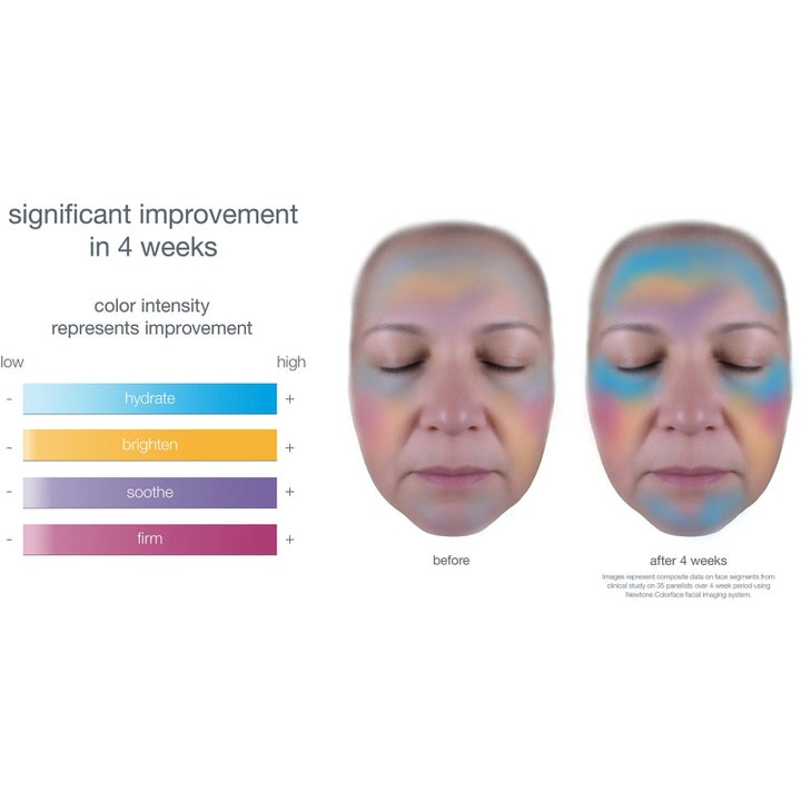 Dermalogica Smart Response Serum 30 ml beroligende ansiktsserum gir fuktighet og fasthet vist med før og etter-bilder.