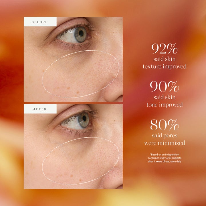KORA Organics Turmeric Glow Drops 10 ml serum viser før og etter bilder med forbedret hudtekstur og mindre synlige porer.