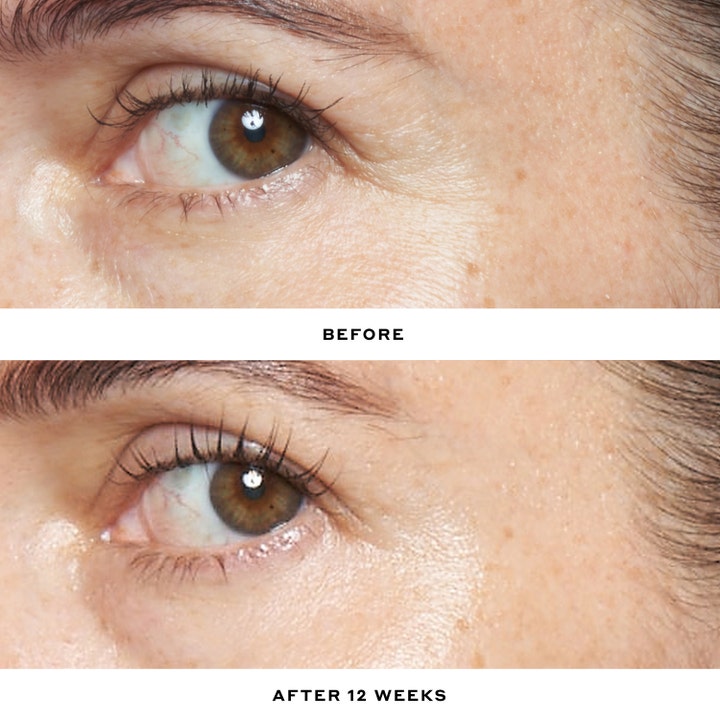 Ole Henriksen Transform Double Rewind 0.3% Retinol Serum 30 ml før og etter 12 uker med færre rynker rundt øyet