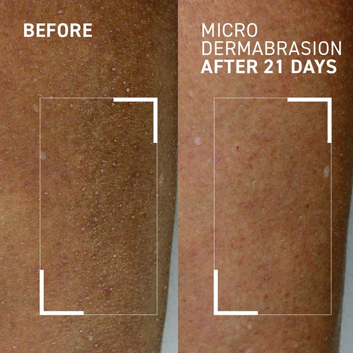 Dr Brandt Microdermabrasion Body Exfoliator 100 g kroppsskrubb viser før og etter resultat med glattere hud etter 21 dager.