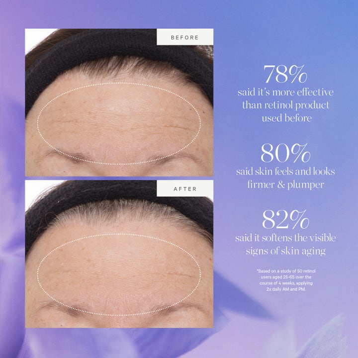 KORA Organics Plant Stem Cell Retinol Alternative Serum 10 ml viser før og etter resultater for fastere hud med færre rynker