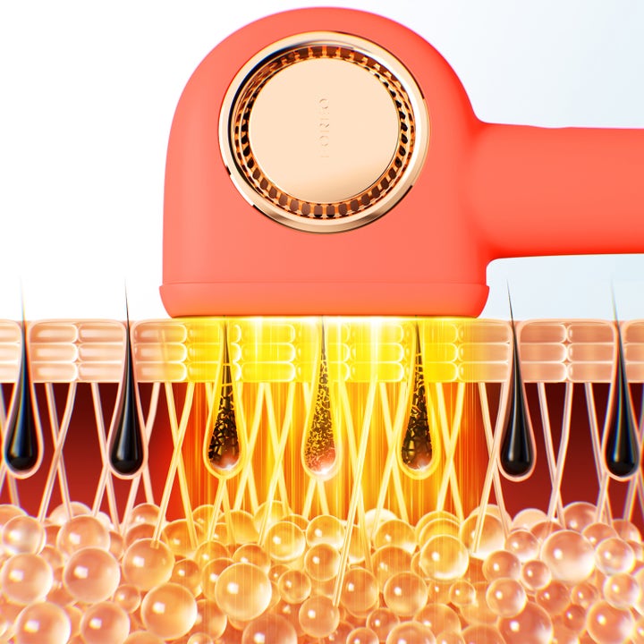 FOREO PEACH 2 Pro Max 1 stk beauty tech som viser lyspulser mot hårsekkene i huden for effektiv hårfjerning