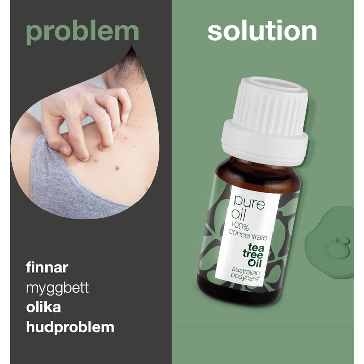 Australian Bodycare Pure Oil 10 ml hudolje mot kviser og hudproblem i brun glassflaske som lindrer kløe.
