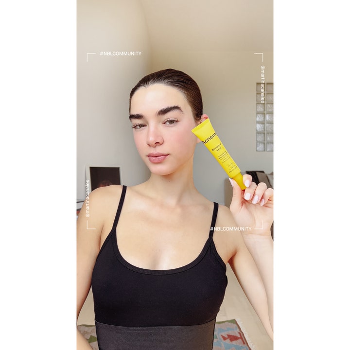 Niche Beauty Lab Acnemy Zitcontrol SPF 50 40 ml dagkrem mot kviser i gul tube som holdes av en kvinne.