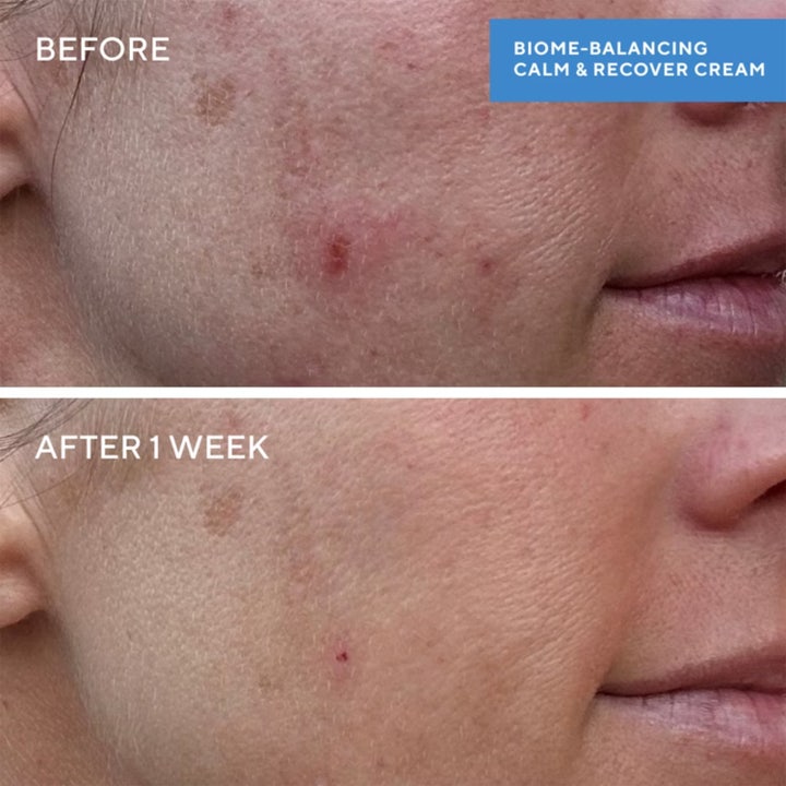 Biome-Balancing Calm + Recover Cream