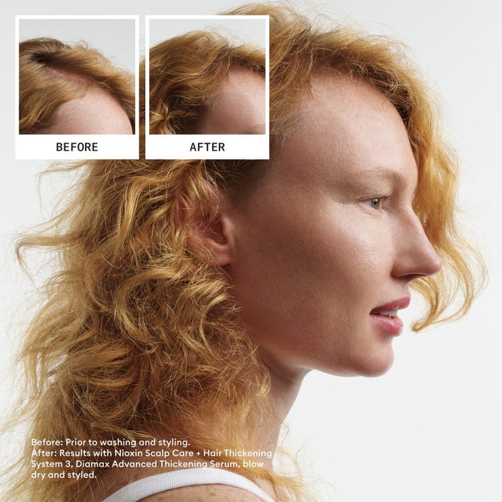 Hair Density & Strength Essentials