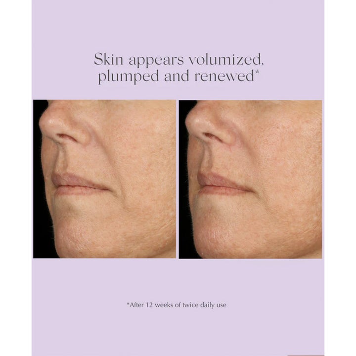 Age Reverse Total Correct + Sculpt Serum