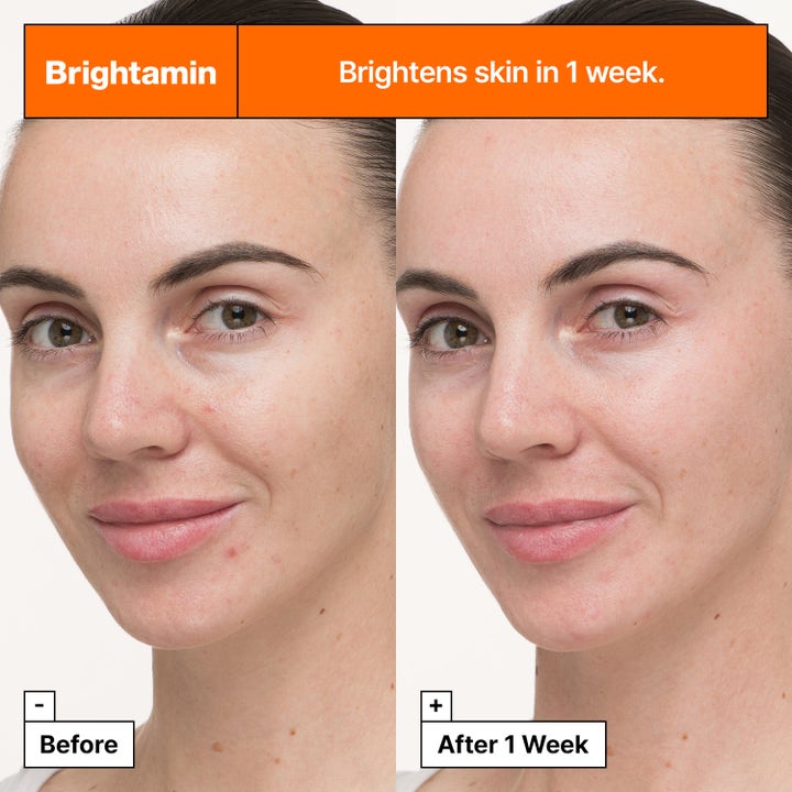 Dr.Jart+ Brightamin Brightening Serum 8,08 g før og etter resultat som gir en jevnere hudtone med mer glød.