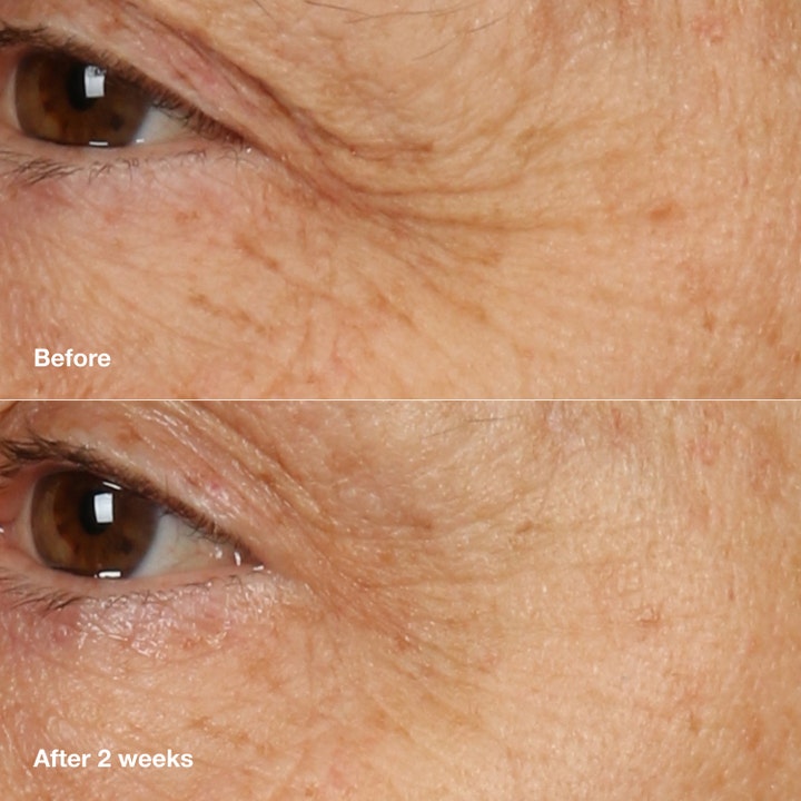 Clinique Smart Clinical Repair Overnight Recovery Cream and Mask 50 ml nattkrem viser reduserte rynker etter to uker.
