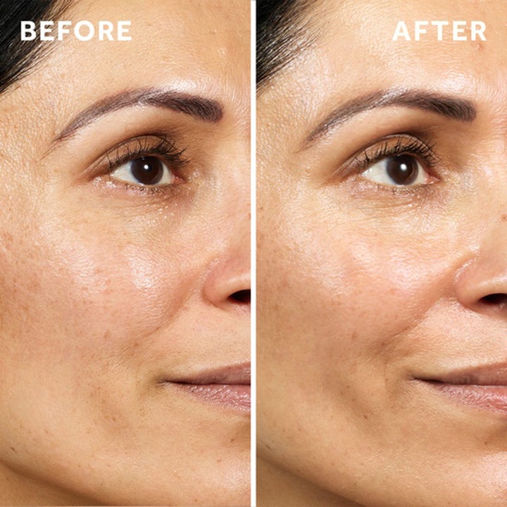 No7 Pure Retinol Triple Action Day Cream Duo 100 ml dagkrem som gir jevnere hud vist med før og etter resultat
