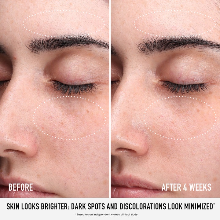 bareMinerals Skin Rescue Pure Glow Serum 30 ml før og etter bilde som viser lysere hud og reduserte mørke flekker