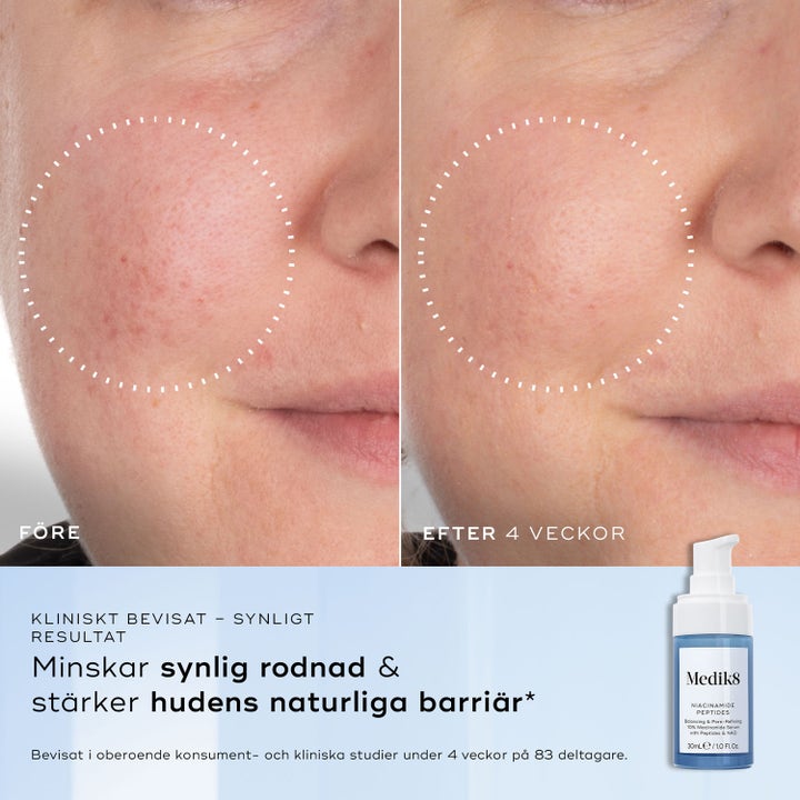 Medik8 Niacinamide Peptides 30 ml toner før og etter resultat som reduserer rødhet og styrker huden