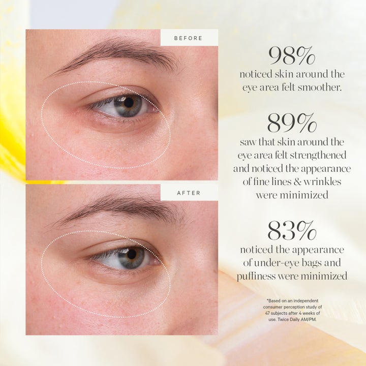 KORA Organics Kakadu Plum Vitamin C Eye Cream Refill 15 ml øyekrem før og etter-bilder som viser glattere hud
