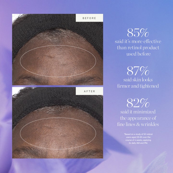 KORA Organics Plant Stem Cell Retinol Alternative Moisturizer 15 ml dagkrem før- og etterbilder for fastere hud.