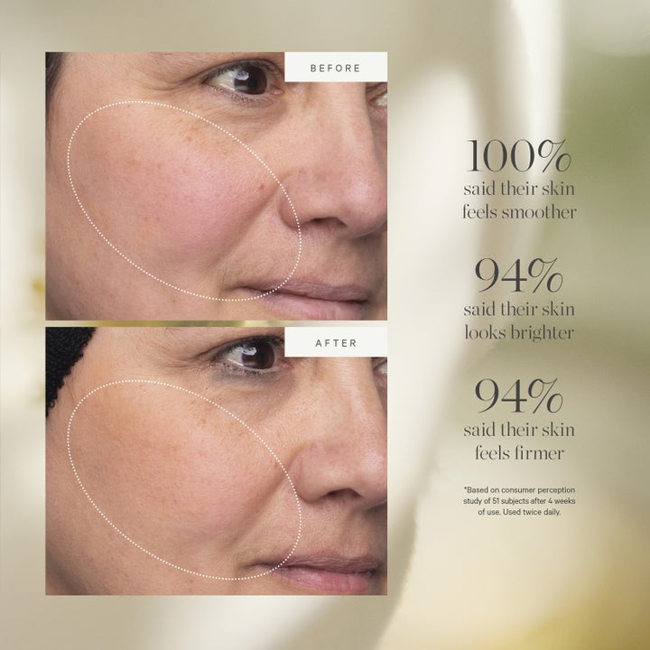 KORA Organics Turmeric Glow Moisturizer 15 ml ansiktskrem før og etter bilder som gir glød og fastere hud
