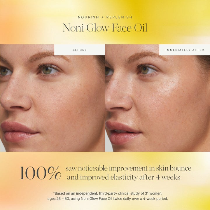 KORA Organics Noni Glow Face Oil 10 ml ansiktsolje før og etter bilder som viser økt glød og elastisitet